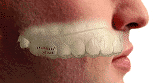 Nose Breathe Mouthpiece Illustration